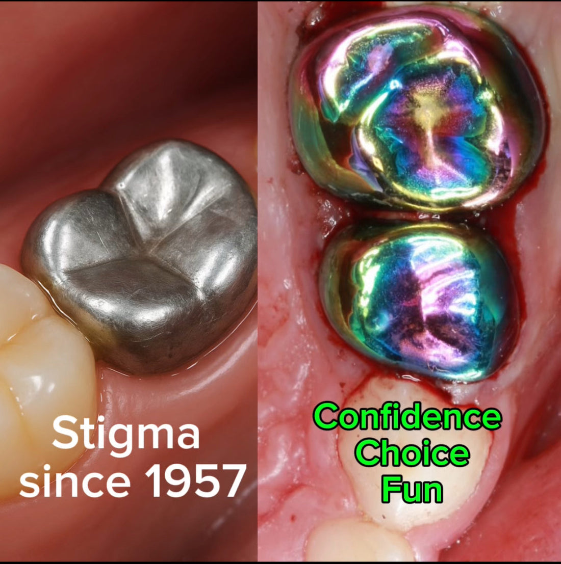 Kids Don’t Want Silver Crowns. They Never Have.